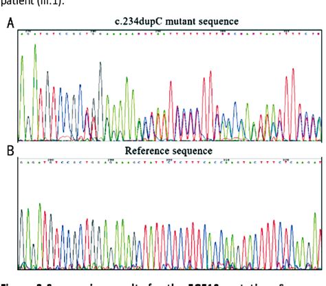 PDF Identification Of A Novel Mutation In The FGF10 Gene In A Chinese