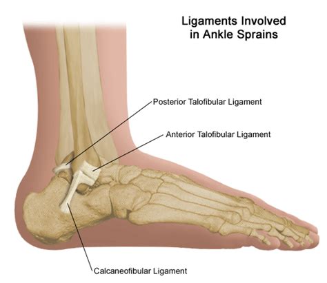 Torn Ligament in Ankle: Treatment and Prevention | New Health Advisor