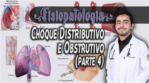 Choque Distributivo E Choque Obstrutivo Parte Fisiopatologia