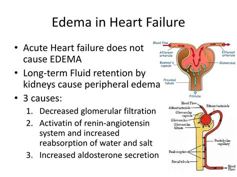 Pitting edema heart failure: Heart Failure Symptoms | Kaiser Permanente