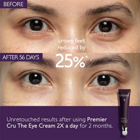 Eyelid Wrinkle Cream