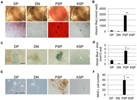 A In Vitro Osteogenesis Of Differentiated Human Ips Cells Days