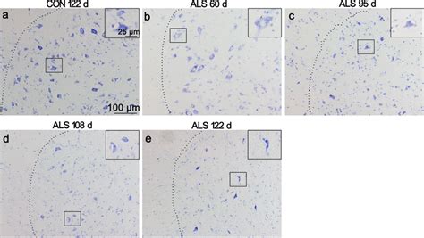 Neural Degeneration In The Ventral Horn Of Als Mice Lumbar Spinal Cord Download Scientific