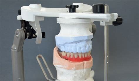 Implantoprotetyka Nowoczesny Technik Dentystyczny