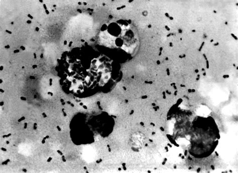 Free picture: bubonic, plague, smear, demonstrating, presence, yersinia ...