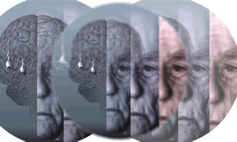 Alzheimer Una Patología Que Enferma A La Familia Infobae