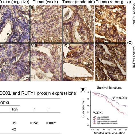 Immunohistochemical Analysis Of Podocalyxinlike Protein PODXL And