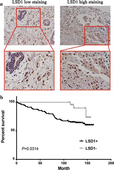 Lsd1 Expression Was Elevated In Breast Cancer Tissues And Was