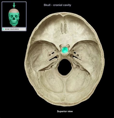 Sphenoid Bone Flashcards | Quizlet