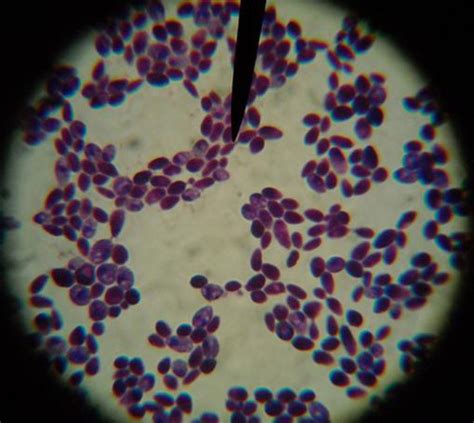 Microbiology Lab Microorganisms Fungi Yeasts And Molds Flashcards