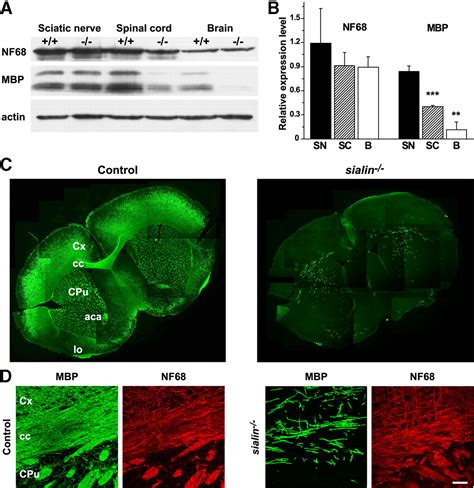 The Lysosomal Sialic Acid Transporter Sialin Is Required For Normal CNS