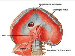 Diaphragmatic Hernia Surgery in Mumbai | ID: 9324660988