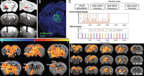 Hemodynamic Transient And Functional Connectivity Follow Structural