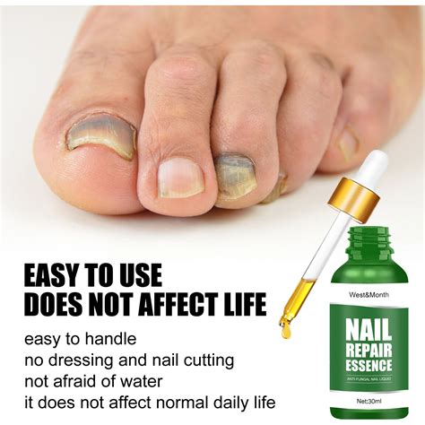 3 Pack Toenail Fungus Treatment Extra Strength Antifungal Solution And