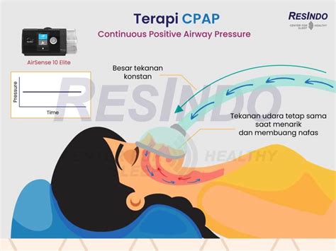 Perbedaan Cpap Apap Dan Bpap Yang Perlu Kamu Tahu Resindo Medika