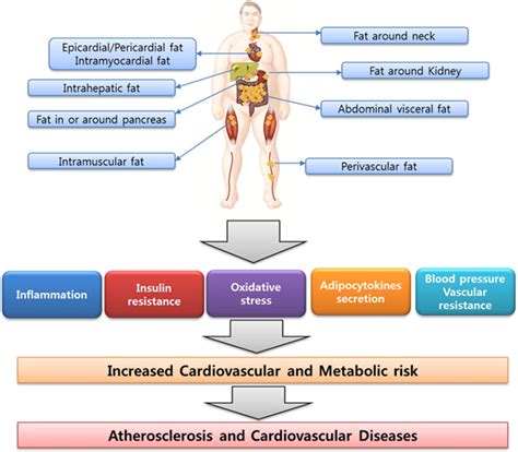 Links Between Ectopic Fat And Vascular Disease In Humans