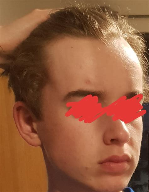 What To Do About The Fivehead Rmalehairadvice