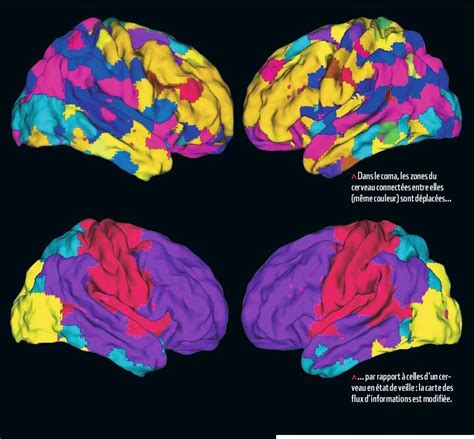 Neurophysiologie dans le coma le cerveau se réorganise Science et vie