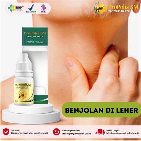 Jual Obat Gondok Hipertiroid Benjolan Dileher Tumor Kelenjar Tiroid