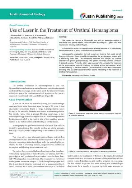 Dermoid Cyst Of The Spermatic Cord Mimicking Incarcerated Inguinal He…