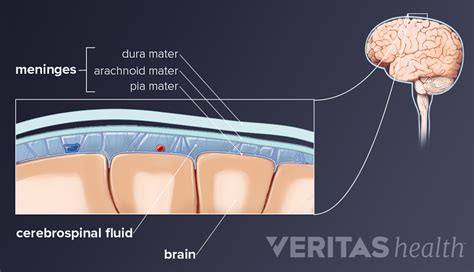 How Meningitis Causes Neck Pain and Stiffness | Spine-health