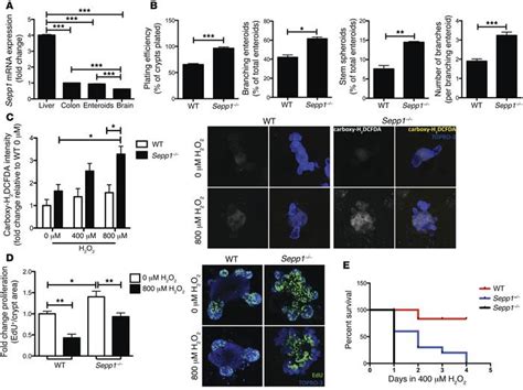 Jci Selenoprotein P Influences Colitis Induced Tumorigenesis By