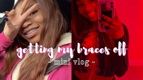 Getting My Braces Off Vlog Youtube