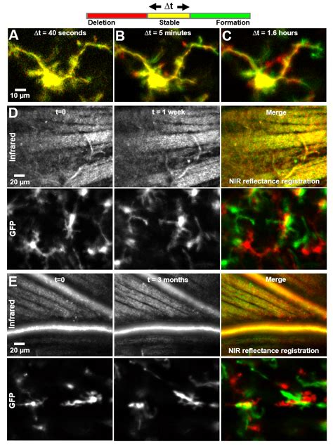 Imaging Single Cell Dynamics Of Microglia From Seconds To Months Each