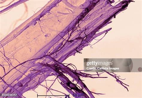 Asbestos Microscope Photos and Premium High Res Pictures - Getty Images