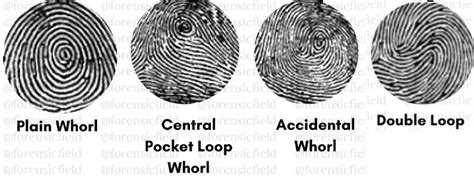 Types Of Fingerprint Patterns - Forensic's blog