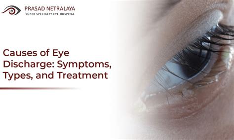 Causes Of Watery Discharge From Eyes - Infoupdate.org