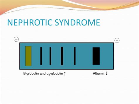 Ppt Electrophoresis And Its Importations Powerpoint Presentation