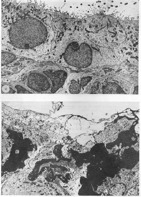 —Ultrastructural view of ependyma damaged by amoscanate. Top: Normal... | Download Scientific ...