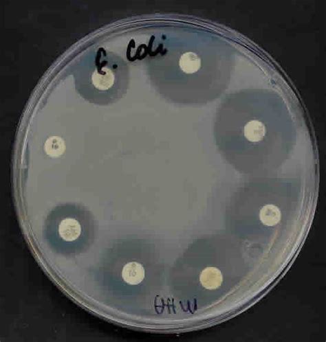 Antimicrobial Susceptibility Testing - Microbiology Resource Center ...