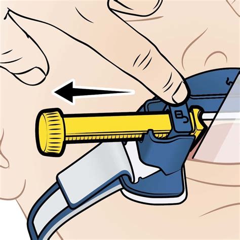 Thomas Tube Holders Laerdal Medical