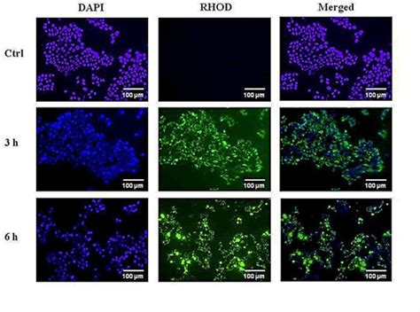 Uptake Of Tothyru Popc De Los Liposomes By Human Mcf Breast