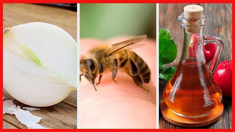 8 Remedios Caseros Para Curar Las Picaduras De Abeja Youtube