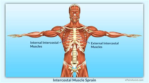 Intercostal Muscle Sprain|Causes|Symptoms|Diagnosis|Treatment-Conservative, Medications