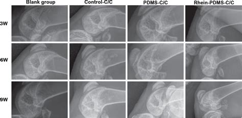 Radiographical Images In Lateral View Of Knee Joint Implanted With The