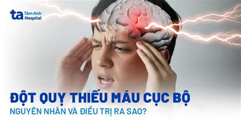 Đột quỵ thiếu máu cục bộ là gì Nguyên nhân triệu chứng và chẩn đoán