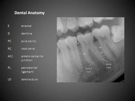 Dental Radiographic Landmarks Dental Dental Anatomy Dental Hygiene