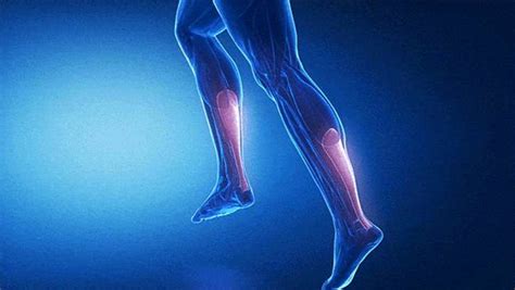 Achilles Tendinopathy Bishopstown Podiatry Clinic