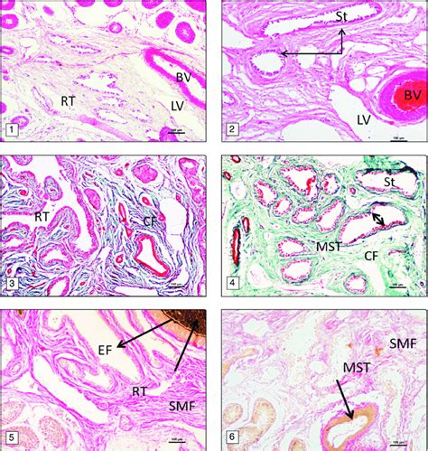 1 Mediastinum Testes Comprised Of Rete Testis Tubules RT Blood