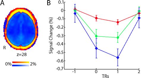 Spatial Distribution And Time Course Of Motion Artifacts A Motion