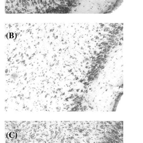 Cellular Pathology In Piriform Cortex Of Untreated Control A 1 Day