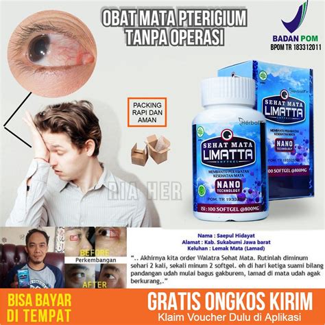 Jual Obat Mata Lemakan Alami Mata Lemak Herbal Obat Mata Berlemak Obat