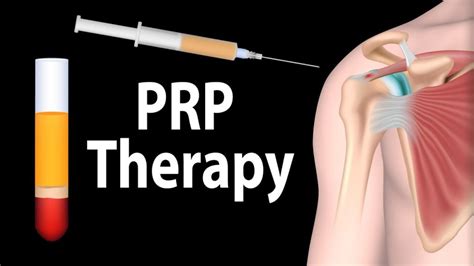 Prp Platelet Rich Plasma Therapy Active Integrated Medical Center