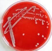 Western blot steps - hiloso