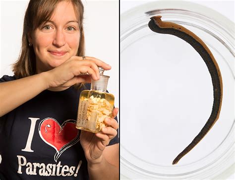 Some Ecologists Value Parasites — And Now Want A Plan To Save Them