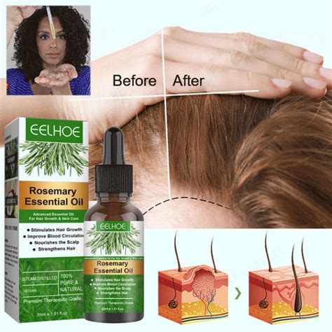 JUELREOURosemary Hair Growth Essential Oil Anti Hair Loss Repair